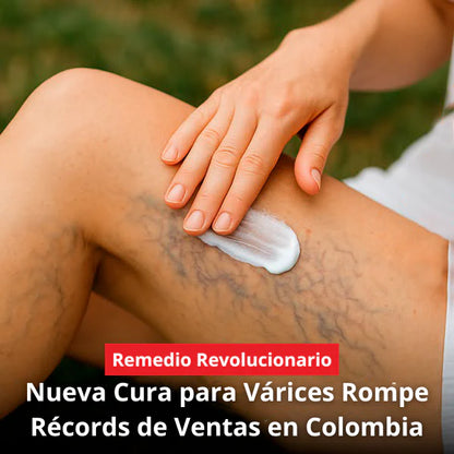 Varicose veins crema para varices