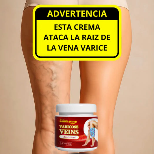 Varicose veins crema para varices