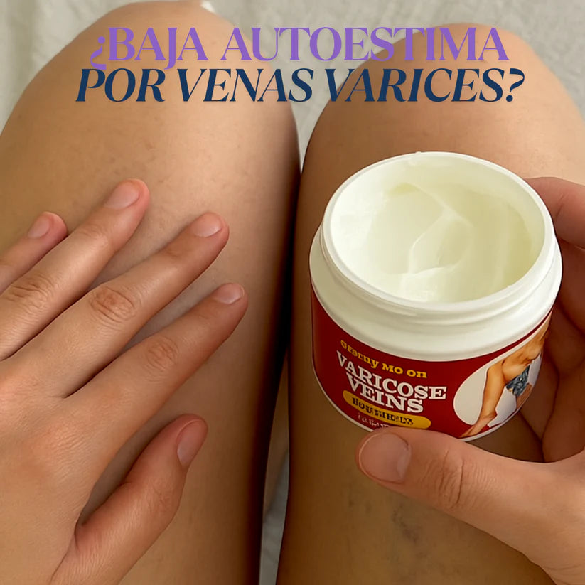 Varicose veins crema para varices